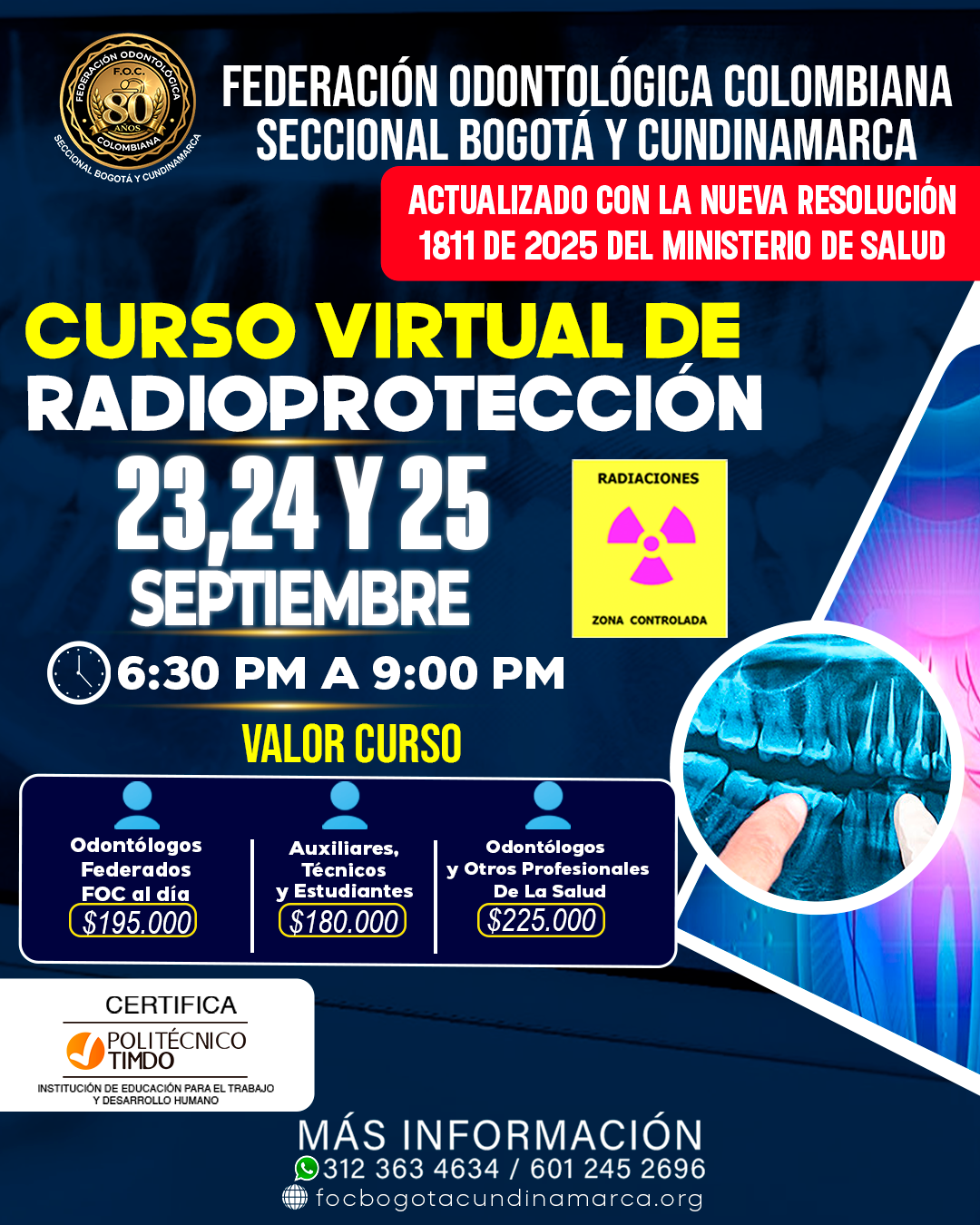 radio sep